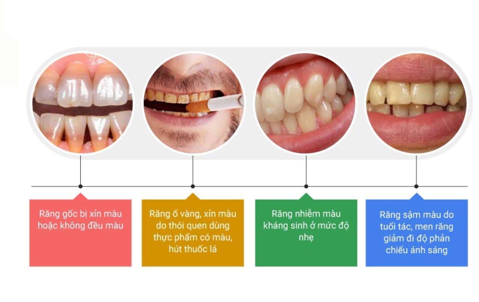 Tẩy trắng răng có bị ê buốt không? 
