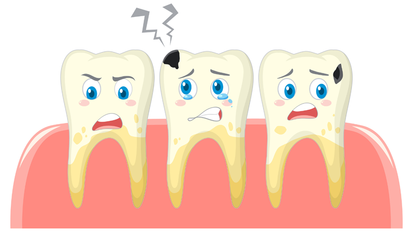 Sâu răng là những tổn thương trên bề mặt răng hoặc men răng